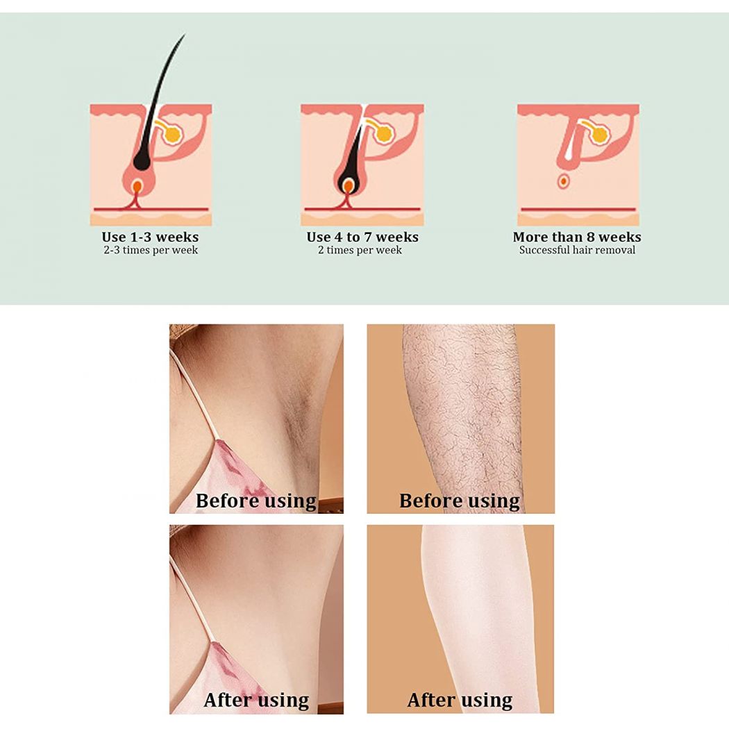 Permanent Wholebody System Upgrade Hair Remover Device
